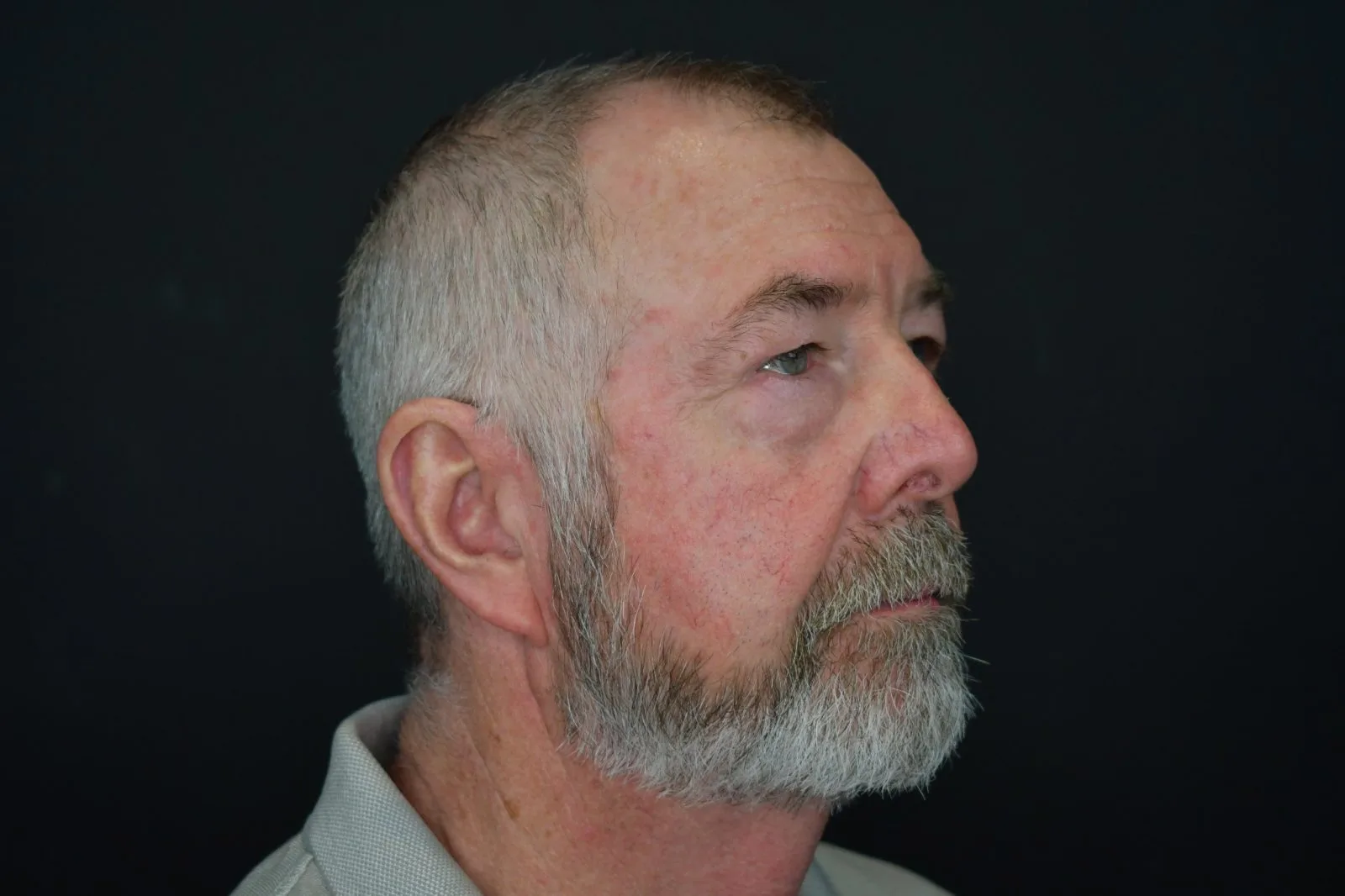 Middle-aged man with gray beard in profile against dark background